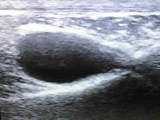 BE Stifle ultrasound